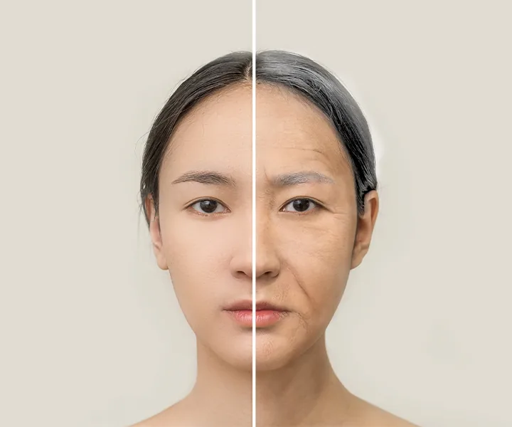 피부재생 / 탄력