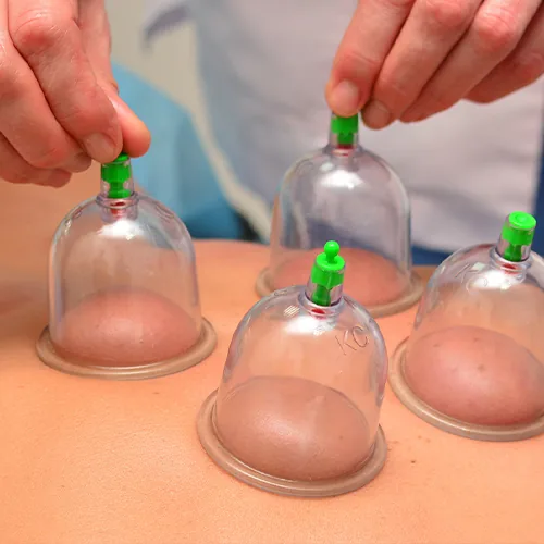 부항치료