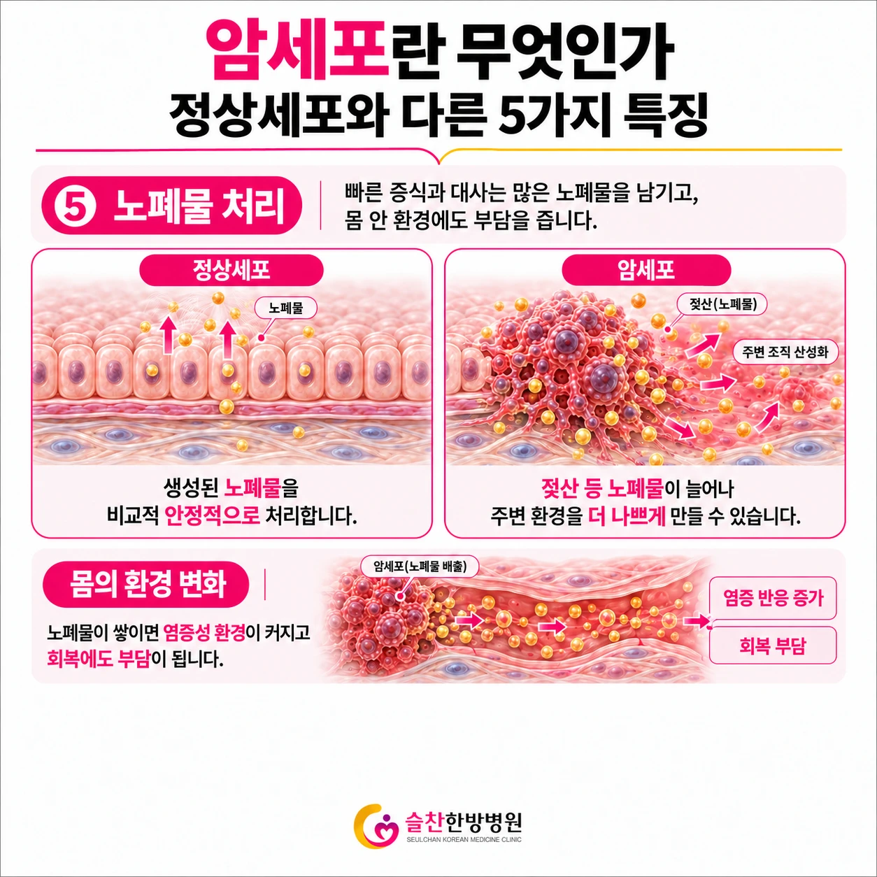 암한방병원 - 암세포란 무엇인가? - 노폐물처리