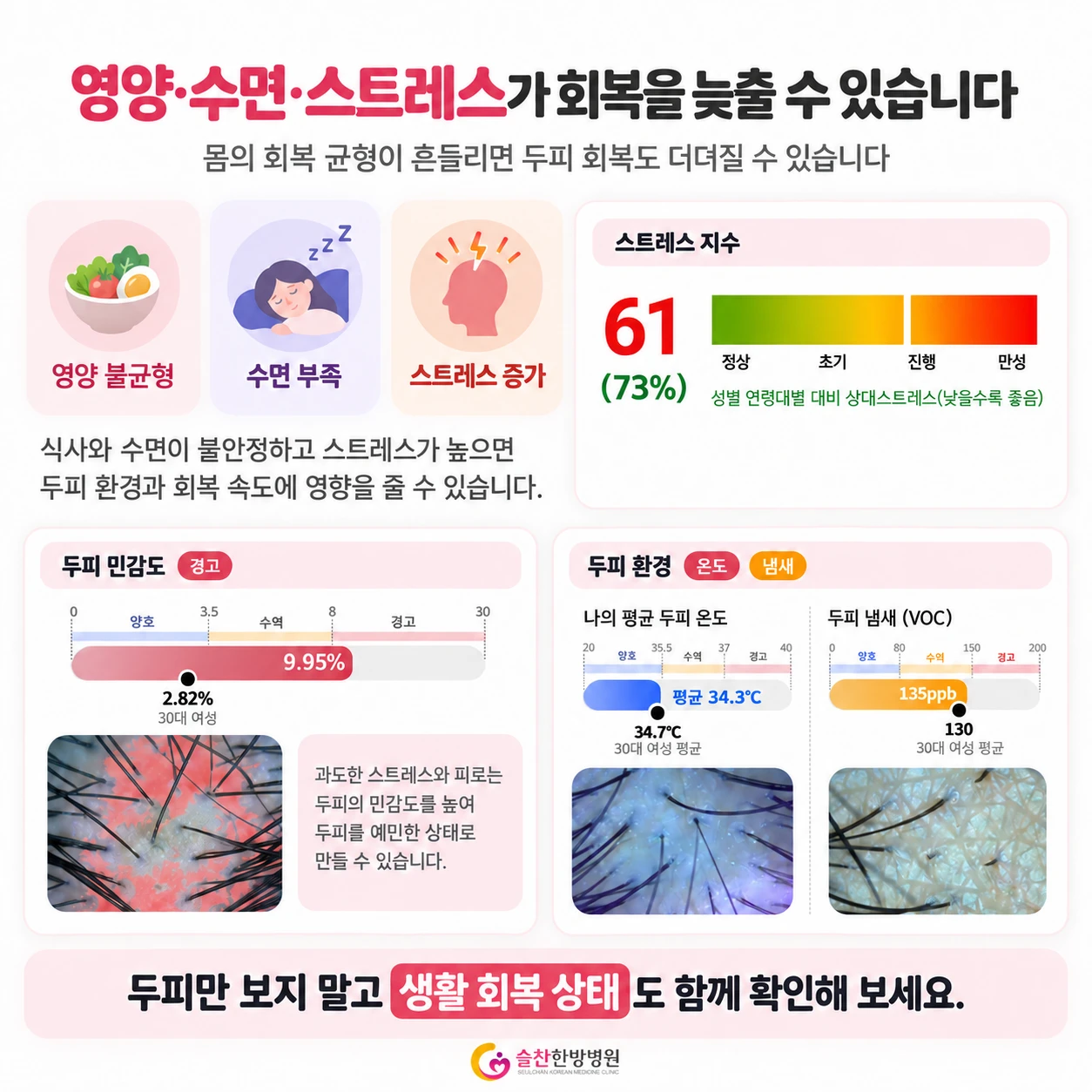 영양·수면·스트레스와 두피 회복의 관계