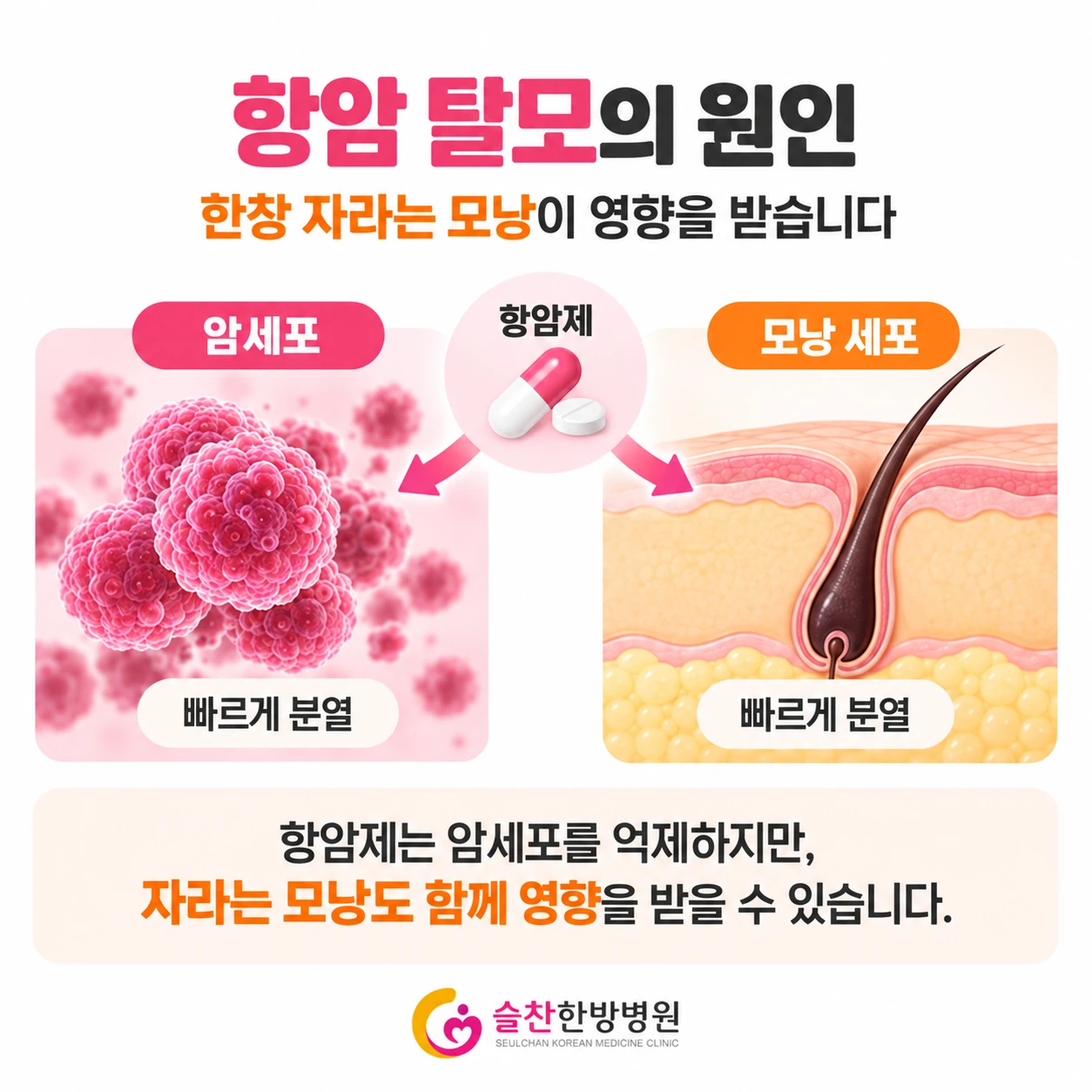 빠르게 분열하는 암세포와 모낭 세포가 함께 영향을 받는 모식도