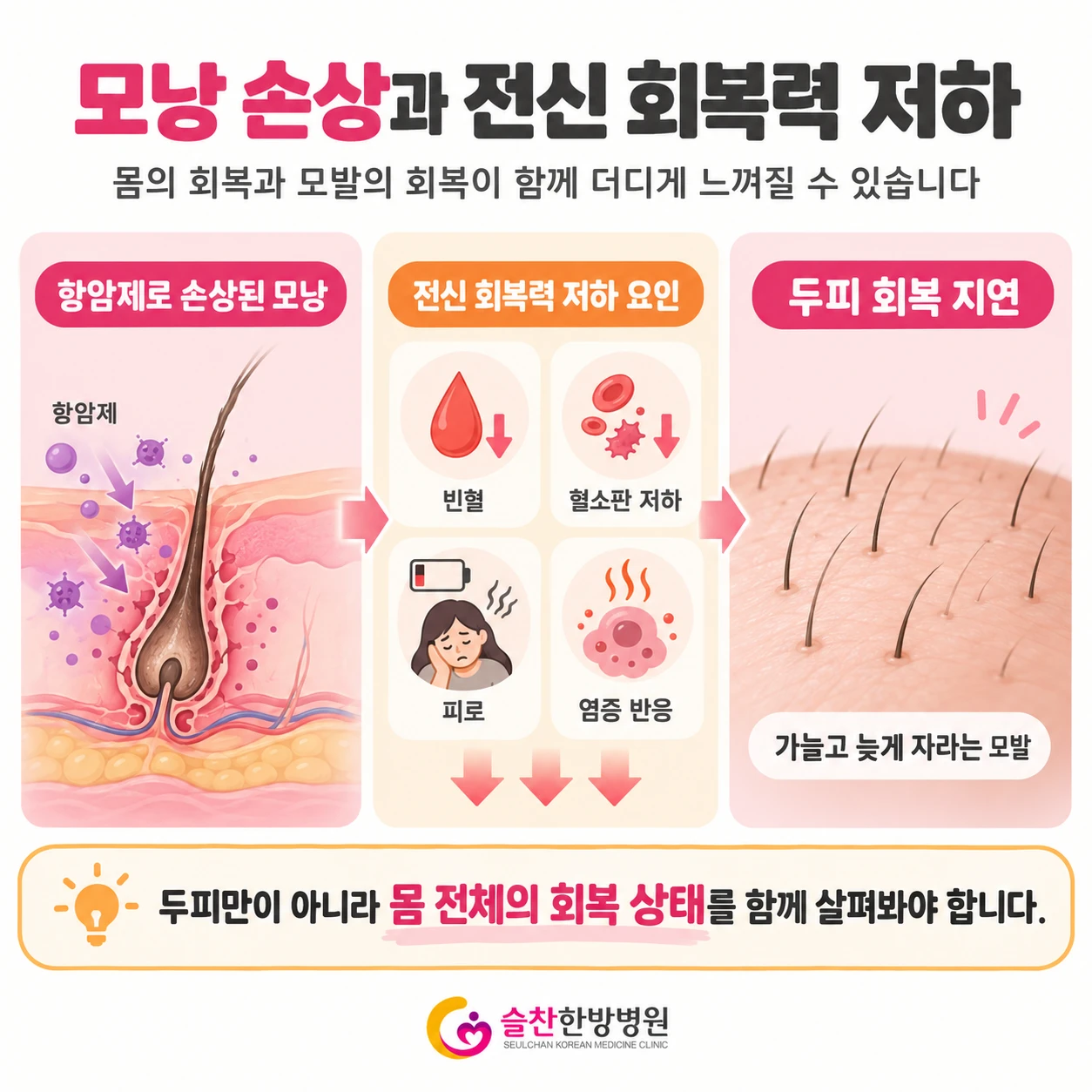 빈혈·피로 등 전신 상태와 모낭 회복의 관계 모식도