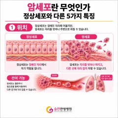 암세포란 무엇인가 | 정상세포와 다른 5가지 특징 (김포슬찬한방병원)