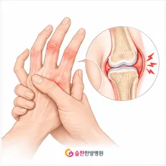 김포암병원, 유방암 호르몬 치료 부작용 4가지 — 약을 끊기 전에 알아둘 것
