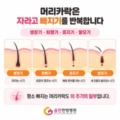 항암 치료 탈모 원인과 치려 후 다시 자라는 시기 — 머리카락 주기로 이해하는 4가지